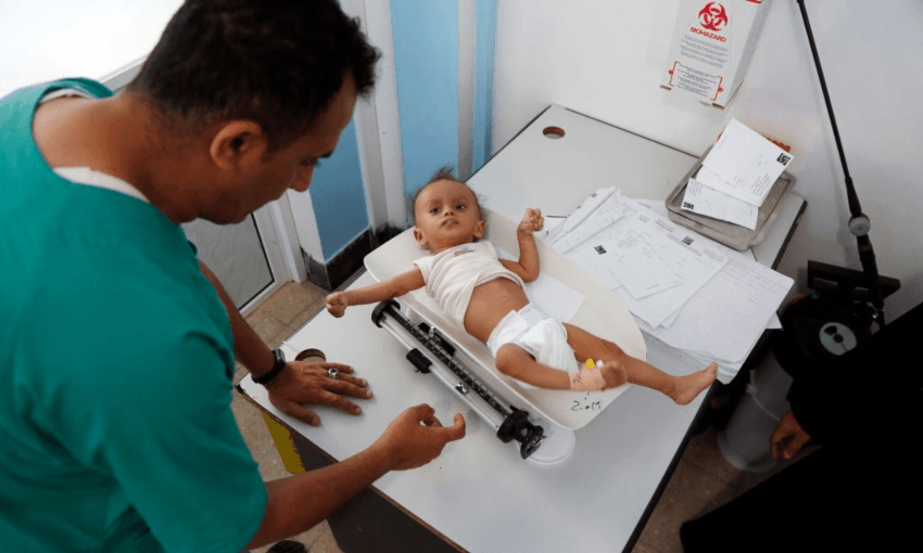 A doctor in Yemen weighing a malnourished child, where more than one in four children are acutely malnourished. (Getty Images) 
